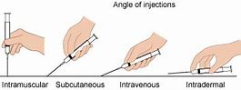 Injeksi Intramuskular Berapa Derajat